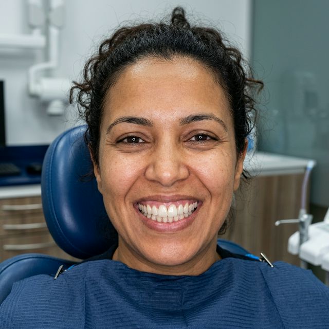 Restauration implantaire Après