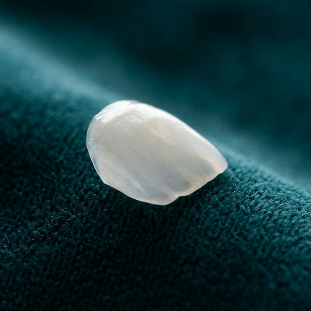 Dentisterie esthétique